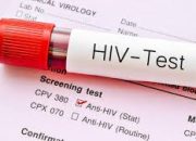 Tahun 2023, Kasus HIV di Anambas Meningkat