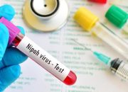 Mengenal Virus Nipah dan Gejalanya